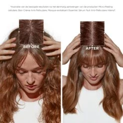 Kérastase Kerastase Symbiose Micro-Peeling Cellulaire 200ml -Schwarzkopf Winkel 3474637135744 13