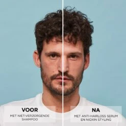 Nioxin Anti-Hairloss Serum 70ml -Schwarzkopf Winkel 361 03