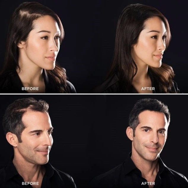 Toppik Hair Building Fibers Dark Brown 27,5gr Toppik Hair Building Fibers Dark Brown 27,5gr -Schwarzkopf Winkel melina and jonathan bacr 2 2 11