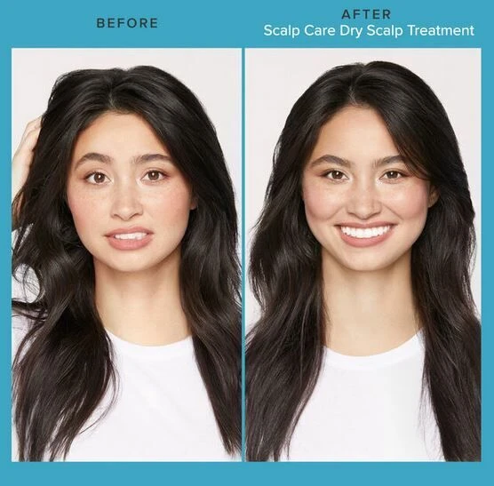 Living Proof Scalp Care Dry Scalp Treatment 100ml Living Proof Scalp Care Dry Scalp Treatment 100ml -Schwarzkopf Winkel scalp care dry scalp sfeerfoto 2