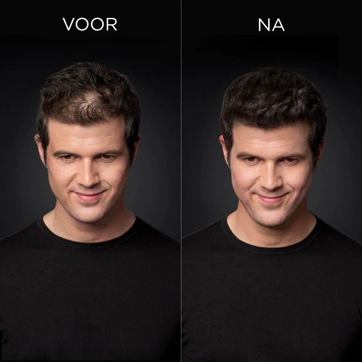 Toppik Colored Thickener Light Brown 144gr Toppik Colored Thickener Light Brown 144gr -Schwarzkopf Winkel toppik hair thickener voor na min 2